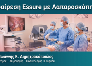 Αφαίρεση Essure με Λαπαροσκόπηση Αφαίρεση Essure με Λαπαροσκόπηση — Δρ. Δημητρακόπουλος Γλυφάδα