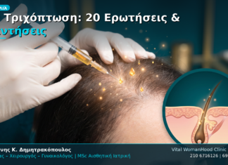 PRP Τριχόπτωση: 20 Ερωτήσεις & Απαντήσεις