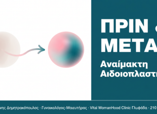 Αναίμακτη Αιδοιοπλαστική: Πριν και Μετά – Τι να Περιμένετε Αναίμακτη Αιδοιοπλαστική: Πριν και Μετά - Τι να Περιμένετε