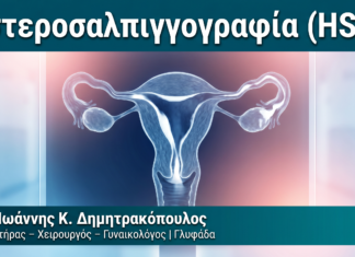 Υστεροσαλπιγγογραφία (HSG) — Δρ. Δημητρακόπουλος Γλυφάδα
