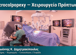 Sacrocolpopexy — Χειρουργείο Πρόπτωσης Sacrocolpopexy — Χειρουργείο Πρόπτωσης — Δρ. Δημητρακόπουλος Γλυφάδα