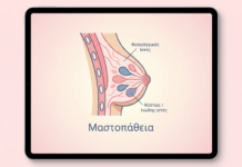 Μαστοπάθεια: Συμπτώματα και Διάγνωση – FAQ