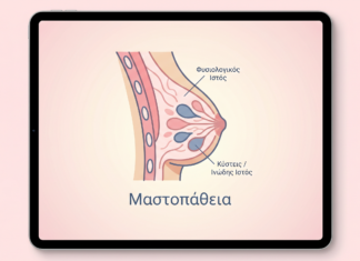 Μαστοπάθεια: Συμπτώματα και Διάγνωση – FAQ