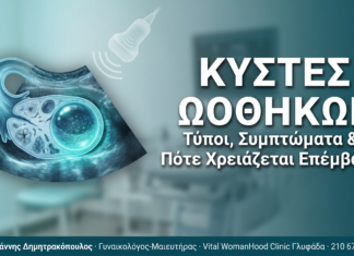 Κύστες ωοθηκών: Τύποι, συμπτώματα και πότε χρειάζεται επέμβαση
