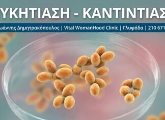 Μυκητίαση (Καντιντίαση): Αίτια, Διάγνωση & Αντιμετώπιση