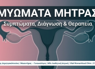 Μυώματα Μήτρας: Συμπτώματα, Διάγνωση & Επιλογές Θεραπείας
