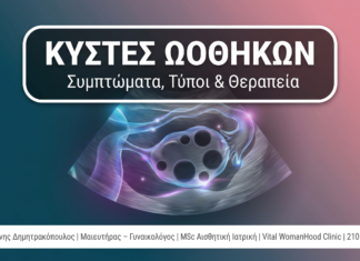 Κύστες Ωοθηκών: Συμπτώματα, Τύποι & Πότε Χρειάζεται Επέμβαση