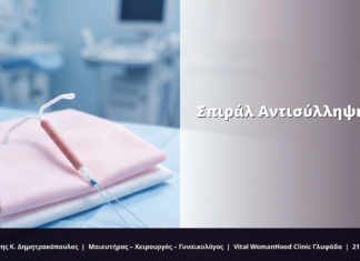 Σπιράλ Αντισύλληψη: FAQ