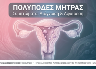 Πολύποδες Μήτρας: Συμπτώματα, Διάγνωση & Αφαίρεση