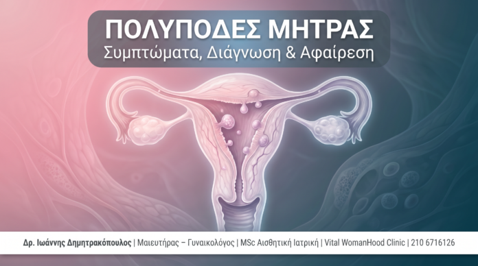 cover_33_polypodes_mitras-1