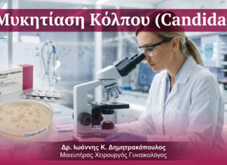 Μυκητίαση Κόλπου (Candida) — FAQ | Γλυφάδα