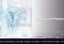 Ινομυώματα Μήτρας: Συμπτώματα & FAQ