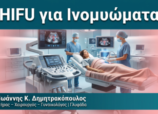 HIFU για Ινομυώματα HIFU για Ινομυώματα — Δρ. Δημητρακόπουλος Γλυφάδα