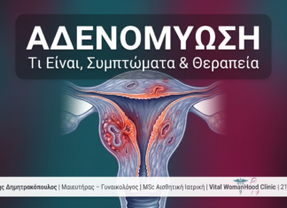 Αδενομυώση: Τι Είναι, Συμπτώματα & Θεραπεία — Γλυφάδα