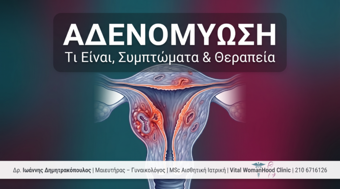 cover_43_adenomyosi