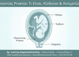 Πλακούντας Praevia: Τι Είναι, Κίνδυνοι & Αντιμετώπιση
