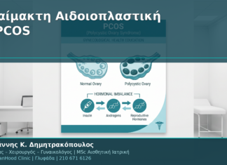 Αναίμακτη Αιδοιοπλαστική & Πολυκυστικές Ωοθήκες (PCOS): Ειδικές Οδηγίες