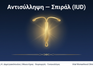 Αντισύλληψη — Σπιράλ (IUD): Ερωτήσεις & Απαντήσεις — Γλυφάδα