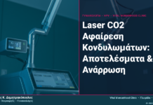Laser CO2 Αφαίρεση Κονδυλωμάτων: Αποτελέσματα & Ανάρρωση