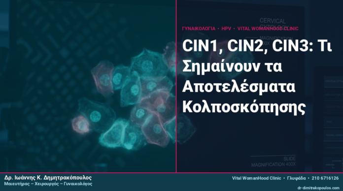 CIN1, CIN2, CIN3: Τι Σημαίνουν τα Αποτελέσματα Κολποσκόπησης CIN1, CIN2, CIN3: Τι Σημαίνουν τα Αποτελέσματα Κολποσκόπησης