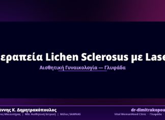 Θεραπεία Lichen Sclerosus με Laser