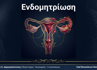 Ενδομητρίωση: Ερωτήσεις & Απαντήσεις — Γλυφάδα Ενδομητρίωση: Ερωτήσεις & Απαντήσεις — Γλυφάδα