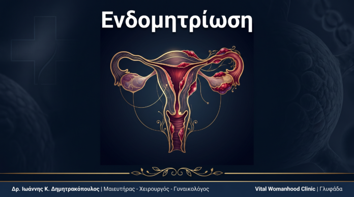 Ενδομητρίωση: Ερωτήσεις & Απαντήσεις — Γλυφάδα
