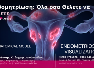 Ενδομητρίωση: Όλα όσα Θέλετε να Ξέρετε