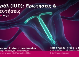 Σπιράλ (IUD): Ερωτήσεις & Απαντήσεις