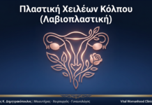Πλαστική Χειλέων Κόλπου (Λαβιοπλαστική): Ερωτήσεις & Απαντήσεις — Γλυφάδα