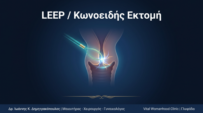 LEEP / Κωνοειδής Εκτομή: Ερωτήσεις & Απαντήσεις — Γλυφάδα LEEP / Κωνοειδής Εκτομή: Ερωτήσεις & Απαντήσεις — Γλυφάδα