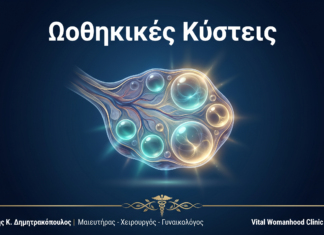 Ωοθηκικές Κύστεις: Ερωτήσεις & Απαντήσεις — Γλυφάδα