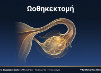 Ωοθηκεκτομή: Ερωτήσεις & Απαντήσεις — Γλυφάδα