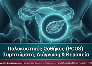 Πολυκυστικές Ωοθήκες (PCOS): Συμπτώματα, Διάγνωση & Θεραπεία