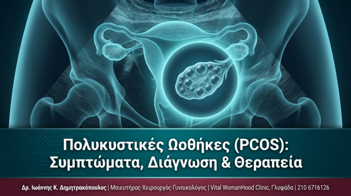 cover_polykistikes-othikes-pcos-symptomata-therapeia