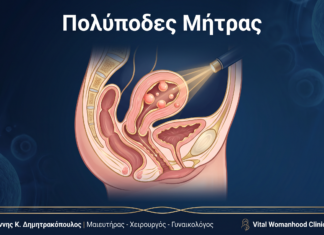 Πολύποδες Μήτρας: Ερωτήσεις & Απαντήσεις — Γλυφάδα Πολύποδες Μήτρας: Ερωτήσεις & Απαντήσεις — Γλυφάδα