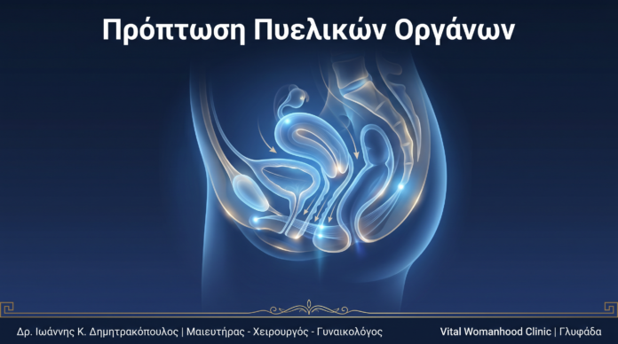 Πρόπτωση Πυελικών Οργάνων: Ερωτήσεις & Απαντήσεις — Γλυφάδα Πρόπτωση Πυελικών Οργάνων: Ερωτήσεις & Απαντήσεις — Γλυφάδα
