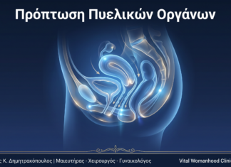 Πρόπτωση Πυελικών Οργάνων: Ερωτήσεις & Απαντήσεις — Γλυφάδα