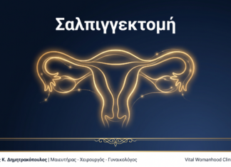 Σαλπιγγεκτομή: Ερωτήσεις & Απαντήσεις — Γλυφάδα