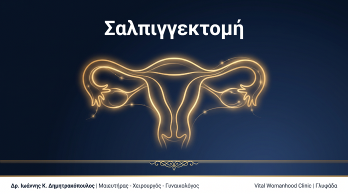 Σαλπιγγεκτομή: Ερωτήσεις & Απαντήσεις — Γλυφάδα Σαλπιγγεκτομή: Ερωτήσεις & Απαντήσεις — Γλυφάδα