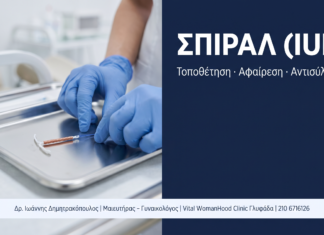 Σπιράλ (IUD): Ερωτήσεις & Απαντήσεις — Τοποθέτηση, Αφαίρεση και Ασφάλεια
