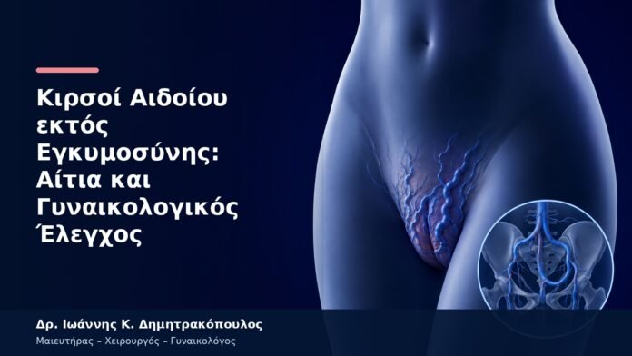 Κιρσοί Αιδοίου εκτός Εγκυμοσύνης: Αίτια και Γυναικολογικός Έλεγχος Κιρσοί Αιδοίου εκτός Εγκυμοσύνης: Αίτια και Γυναικολογικός Έλεγχος