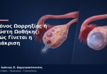 Πόνος Ωορρηξίας ή Κύστη Ωοθήκης: Πώς Γίνεται η Διάκριση Πόνος Ωορρηξίας ή Κύστη Ωοθήκης: Πώς Γίνεται η Διάκριση