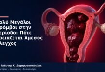 Πολύ Μεγάλοι Θρόμβοι στην Περίοδο: Πότε Χρειάζεται Άμεσος Έλεγχος Πολύ Μεγάλοι Θρόμβοι στην Περίοδο: Πότε Χρειάζεται Άμεσος Έλεγχος