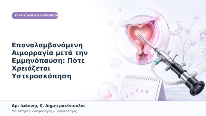 Επαναλαμβανόμενη Αιμορραγία μετά την Εμμηνόπαυση: Πότε Χρειάζεται Υστεροσκόπηση Επαναλαμβανόμενη Αιμορραγία μετά την Εμμηνόπαυση: Πότε Χρειάζεται Υστεροσκόπηση
