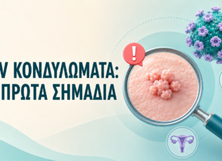 HPV κονδυλώματα: Ποια είναι τα πρώτα σημάδια;