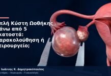 Απλή Κύστη Ωοθήκης Πάνω από 5 Εκατοστά: Παρακολούθηση ή Χειρουργείο;