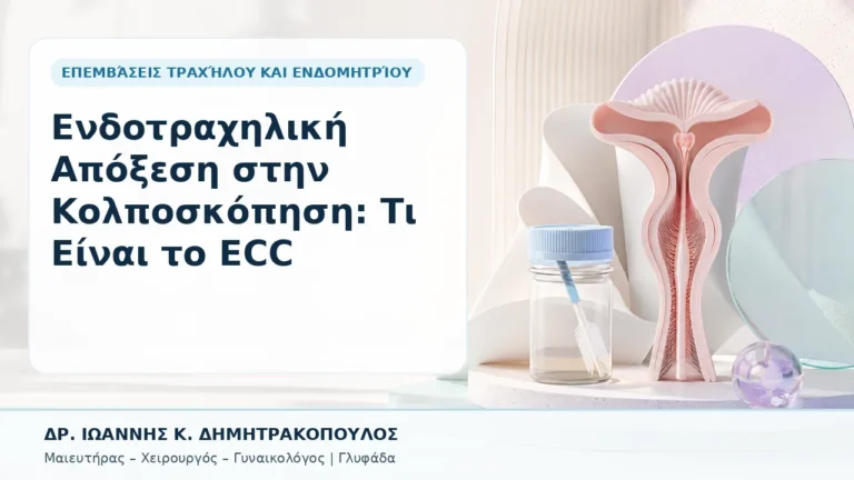 Ενδοτραχηλική Απόξεση στην Κολποσκόπηση: Τι Είναι το ECC - Δρ. Ιωάννης Κ. Δημητρακόπουλος, Γυναικολόγος Γλυφάδα
