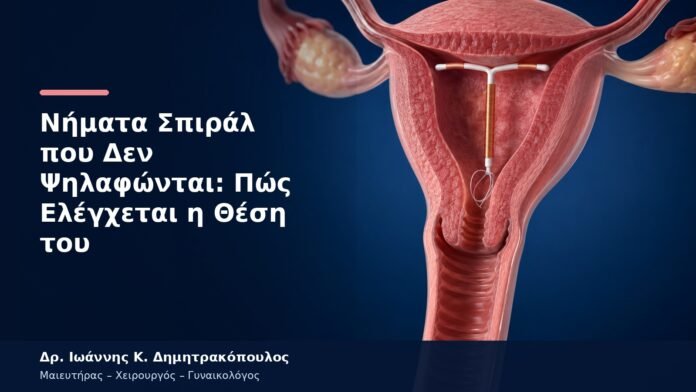 Νήματα Σπιράλ που Δεν Ψηλαφώνται: Πώς Ελέγχεται η Θέση του Νήματα Σπιράλ που Δεν Ψηλαφώνται: Πώς Ελέγχεται η Θέση του