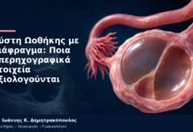Κύστη Ωοθήκης με Διάφραγμα: Ποια Υπερηχογραφικά Στοιχεία Αξιολογούνται